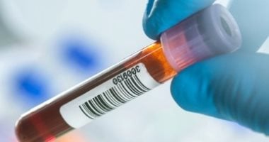 بعد إعلان الصحة العالمية نجاح مصر فى القضاء على المرض.. ما هو داء الفيلاريات اللمفي بعد إعلان الصحة العالمية نجاح مصر فى القضاء على المرض.. ما هو داء الفيلاريات اللمفي