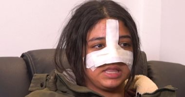 بعد ظهور كارما فى حالة سيئة.. طبيب نفسى يوضح دور المجتمع والأهل فى تعافيها بعد ظهور كارما فى حالة سيئة.. طبيب نفسى يوضح دور المجتمع والأهل فى تعافيها