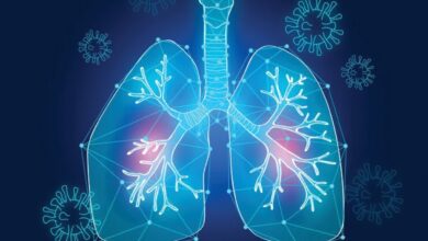 “فيروس HMPV في الصين.. هل نحن أمام جائحة ؟”