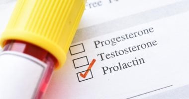 أسباب ارتفاع هرمون البرولاكتين عند النساء أسباب ارتفاع هرمون البرولاكتين عند النساء