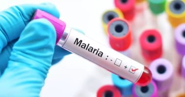 الصحة العالمية توافق على اختبار تشخيصى لدعم العلاجات الآمنة للملاريا الصحة العالمية توافق على اختبار تشخيصى لدعم العلاجات الآمنة للملاريا