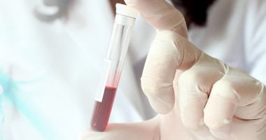 دراسة تحذر: جرثومة المعدة ترفع الإصابة بفقر الدم لدى الأطفال.. نصائح للوقاية دراسة تحذر: جرثومة المعدة ترفع الإصابة بفقر الدم لدى الأطفال.. نصائح للوقاية