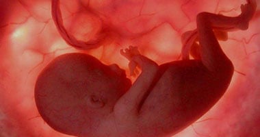 فى حالة نادرة بالهند.. اكتشاف جنينين داخل بطن رضيع "فيديو" فى حالة نادرة بالهند.. اكتشاف جنينين داخل بطن رضيع "فيديو"