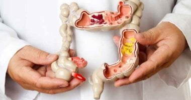 فى هذه الحالات منظار القولون ضرورى قبل سن الــ45 فى هذه الحالات منظار القولون ضرورى قبل سن الــ45