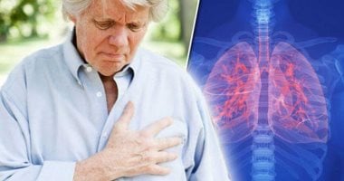 التدخين وأشياء أخرى.. دراسات تكشف أسباب سرطان الرئة عند غير المدخنين