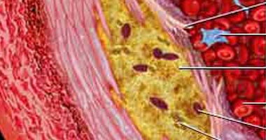 الكوليسترول مش مضر.. 7 خرافات عنه لا تصدقها