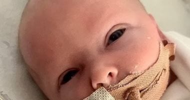 مالوش اسم.. مرض نادر يصيب طفلاً بريطانيًا بين 23 حالة فقط في العالم