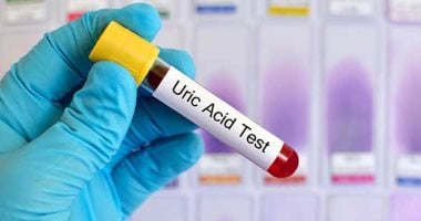 لو بتعانى من ارتفاع حمض اليوريك.. أفضل نظام غذائى ونصائح فى رمضان