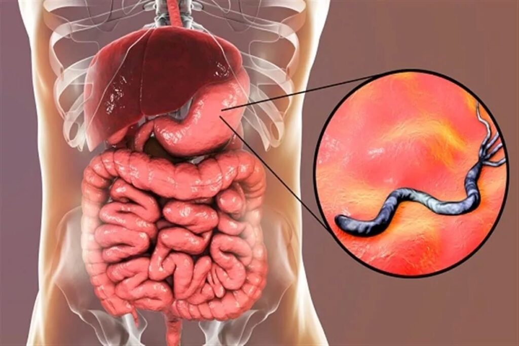 الدكتورة منار حامد : أورام القولون والمستقيم من أكتر أنواع الأورام انتشارا الدكتورة منار حامد : أورام القولون والمستقيم من أكتر أنواع الأورام انتشارا